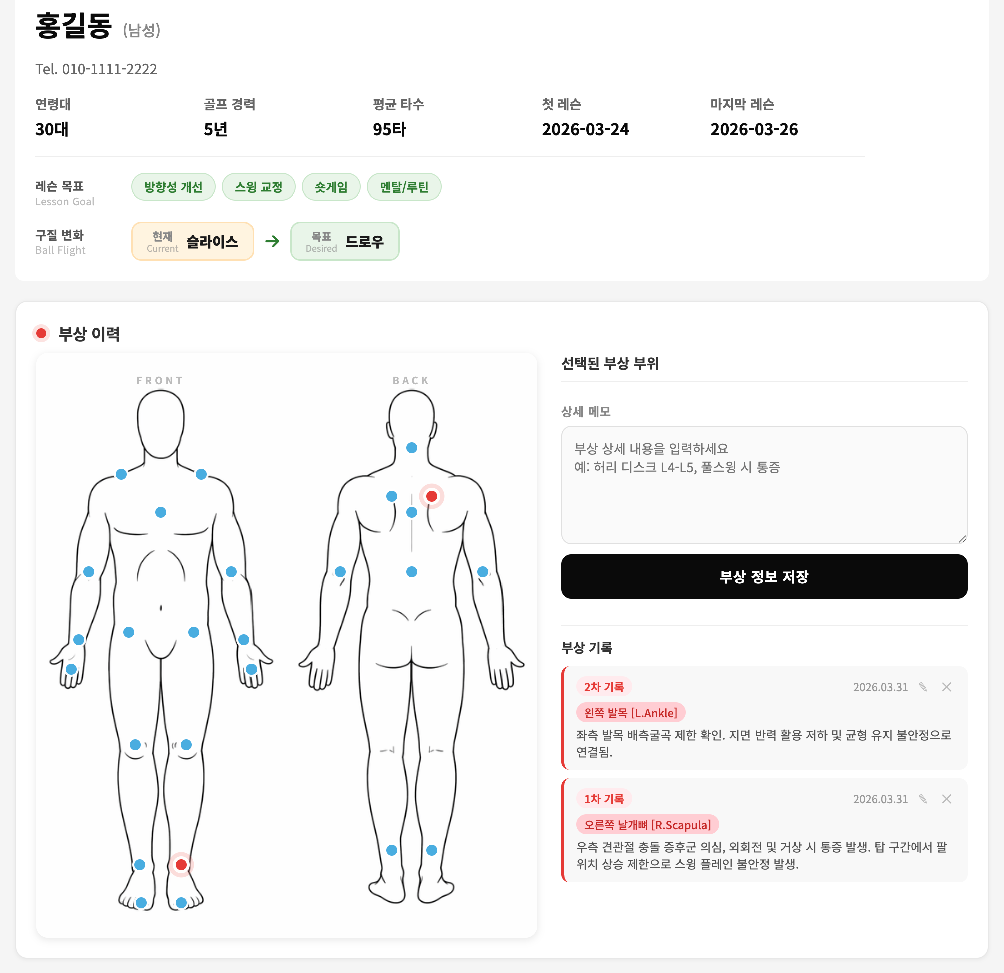 SWINGDYNE 고객 프로필 — 목표 설정 & 부상 이력 관리